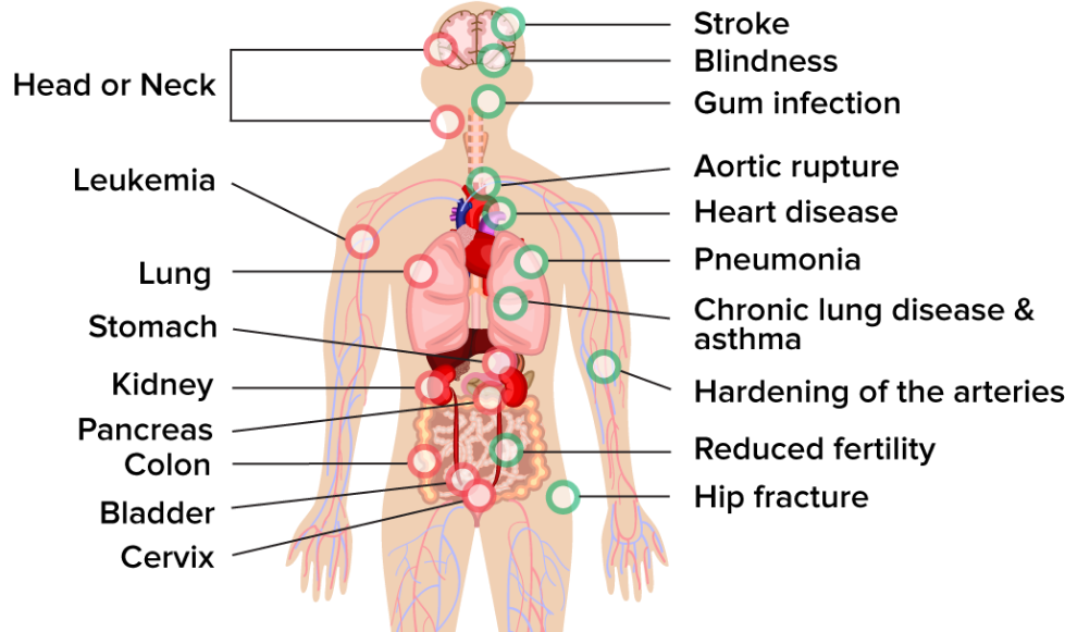 Human body with the areas affected by Smoking related diseases